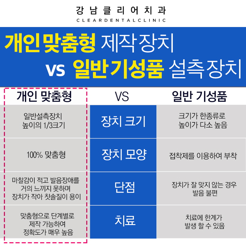 설측교정 교정한거 아무도 몰라요 관련 이미지 6