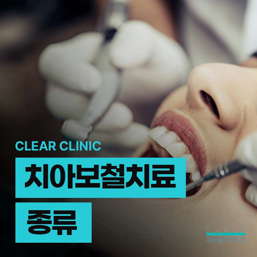 치아보철치료 종류 단계에 따라 관련 이미지 1