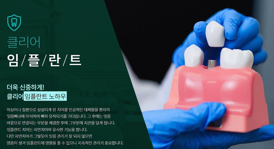 강남역 임플란트치과 관심 있게 찾아보고 관련 이미지 3