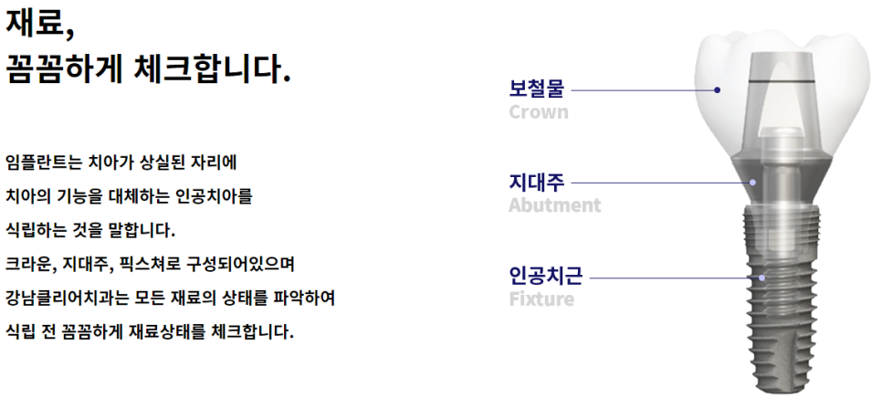 20대 임플란트 잘하는곳 강남치과 선택해봐요! 관련 이미지 5