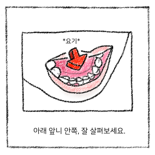 치아 스케일링 보험적용, 가격, 스케일링 후 주의사항 관련 이미지 7