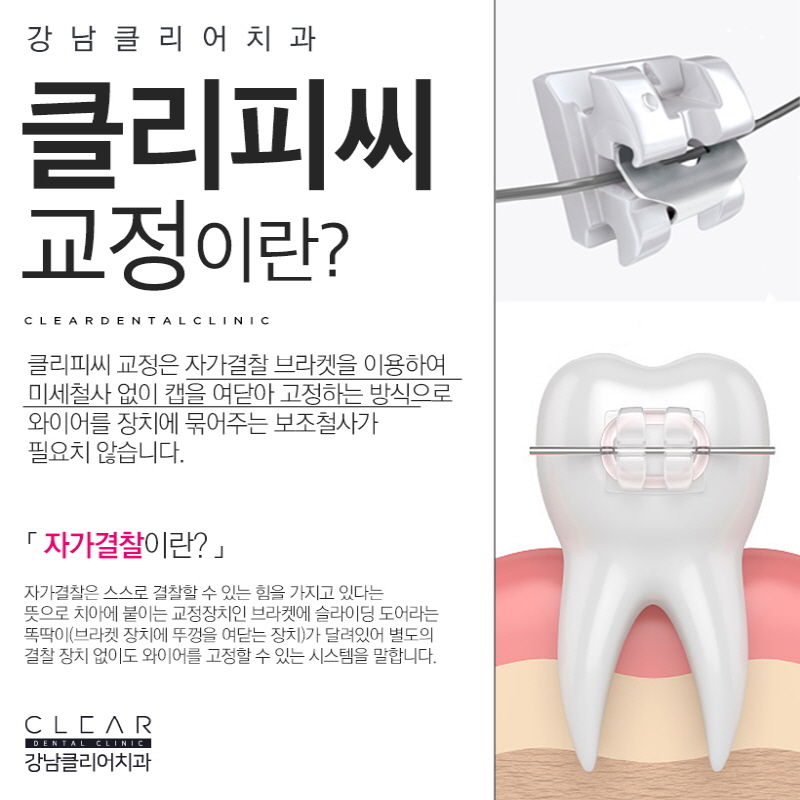 클리피씨교정비용 가격 이벤트로 혜택받기 관련 이미지 2