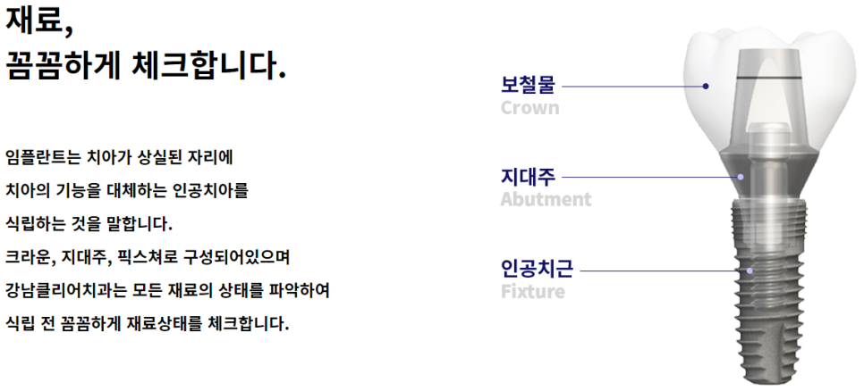 강남임플란트수술 방법까지도 알아보자 관련 이미지 3