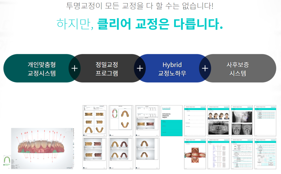 치아 부정교합 강남역치과에서 상담부터 관련 이미지 6