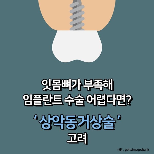 잇몸뼈가 부족해 임플란트 수술 어렵다면? 관련 이미지 1