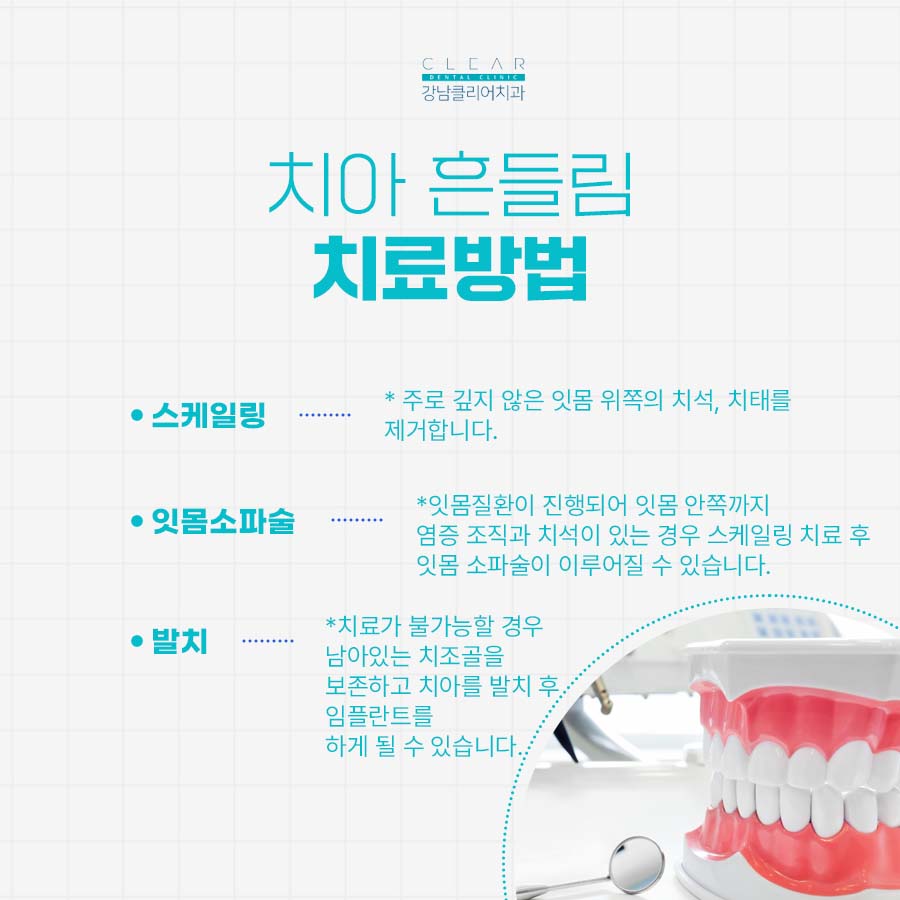 클리어치과 치아 흔들림 원인 치료방법 알려드려요 관련 이미지 3