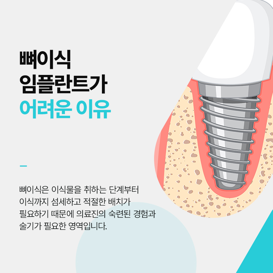 역삼역 임플란트 치과 뼈이식으로 튼튼한 식립을 관련 이미지 3