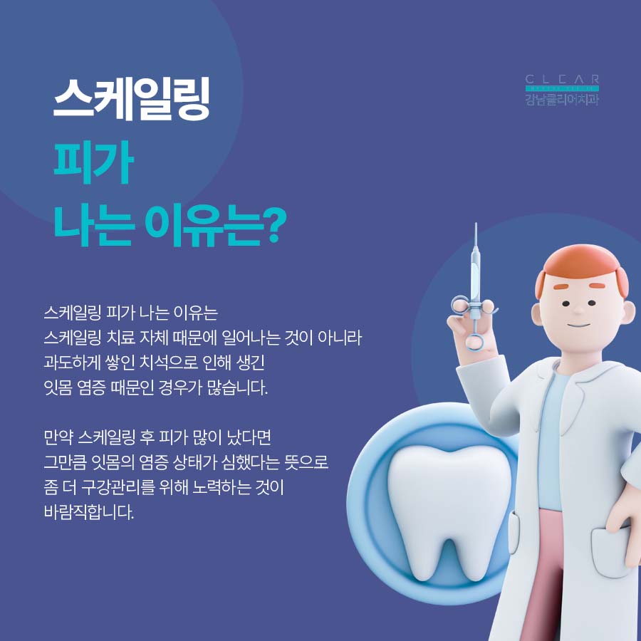 스케일링 피 원인 치료방법에 대해 관련 이미지 3