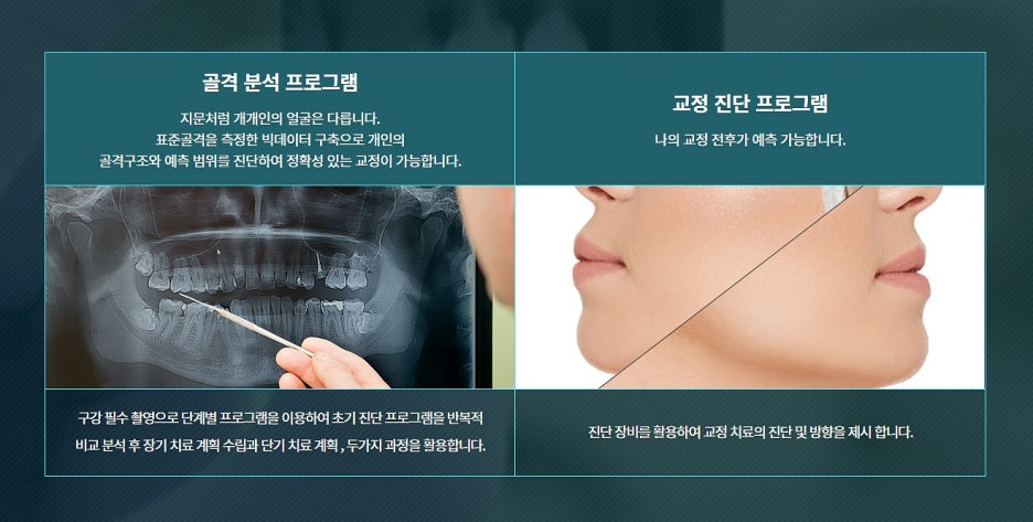강남 클리피씨 교정으로 만족도 높이기 관련 이미지 5