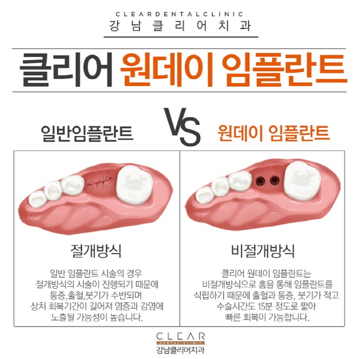 국산임플란트 가격 안정성 모두 경쟁력있어 관련 이미지 6