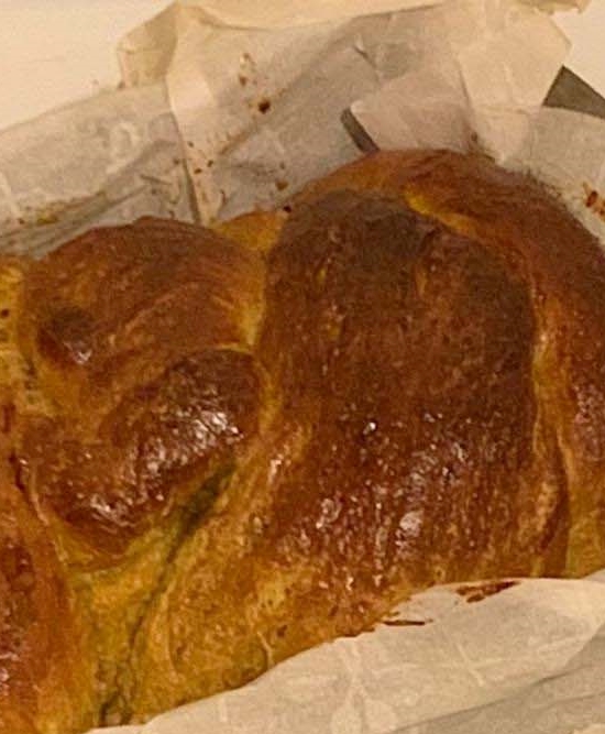 잇몸퇴축 치료 치실과 치간칫솔 사용법 중요해 관련 이미지 26