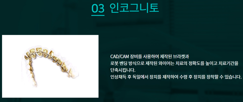 강남설측교정 꼼꼼한 진료를 해주는 곳을 찾는다면 관련 이미지 5
