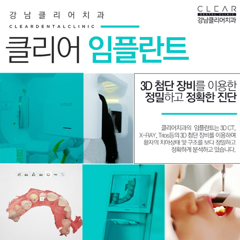 오스템임플란트 SOI임플란트 무엇이 다를까요? 관련 이미지 8