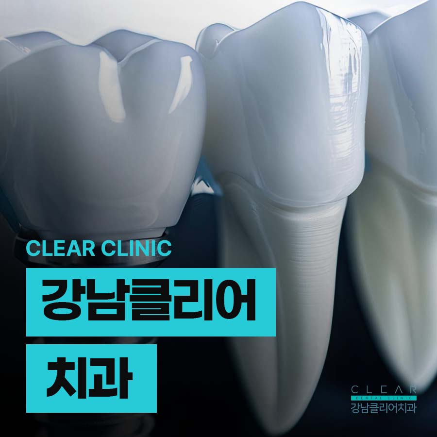 강남클리어치과 상악동 거상술도 가능하니까 관련 이미지 1