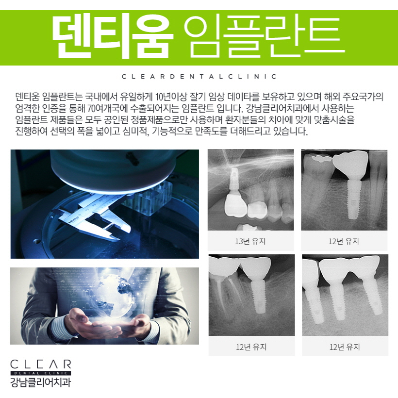 강남역임플란트 덴티움 국내유일10년이상 임상데이타 보유 관련 이미지 4