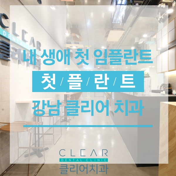 내 생에 첫 임플란트 관련 이미지 1