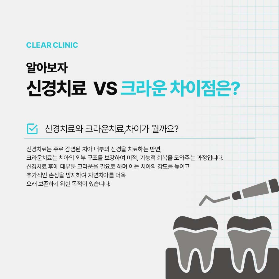 강남클리어치과 신경치료 과정 크라운치료 비교 관련 이미지 4
