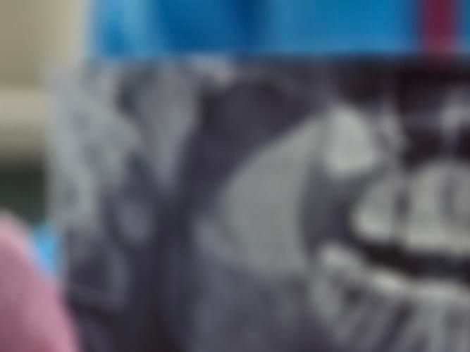 신경치료 후 통증이 생기는 이유 관련 이미지 15