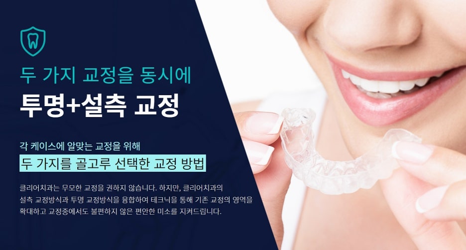 클리어치과 교정 아무데서나 말고 신중하게 관련 이미지 3