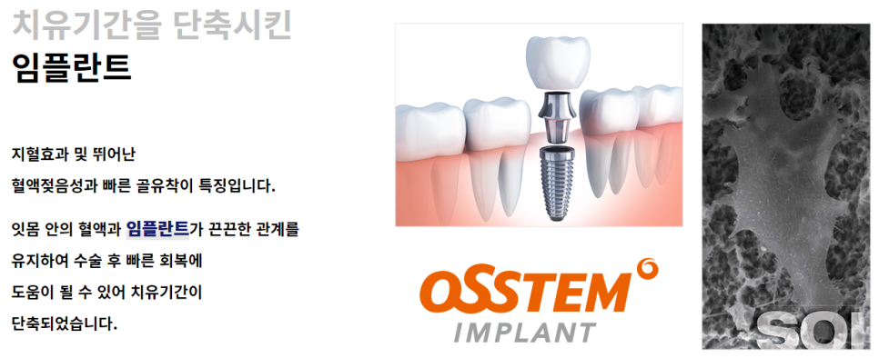 서울임플란트잘하는곳 찾는 방법 관련 이미지 3