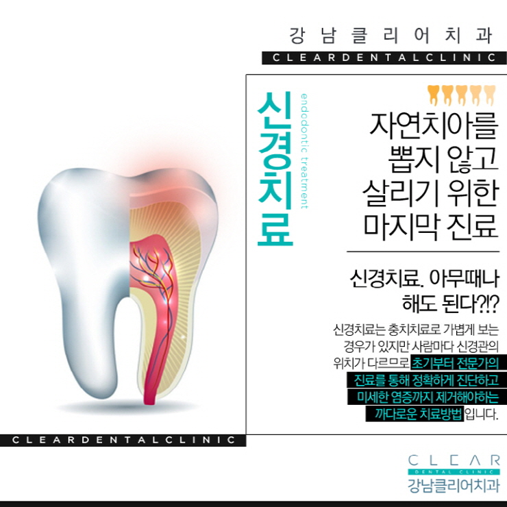 치아 신경치료 과정 순서 통증 등 신경치료의 모든것 관련 이미지 9