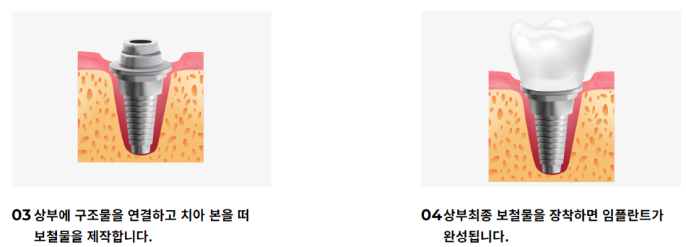 역삼동치과추천 다양한 치아진료가 가능한 곳 관련 이미지 9