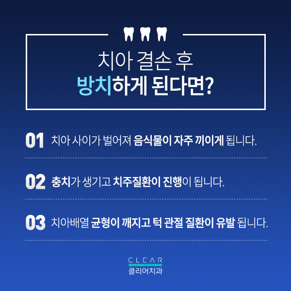 임플란트 궁금증 해결하러 왔어요~ 관련 이미지 2