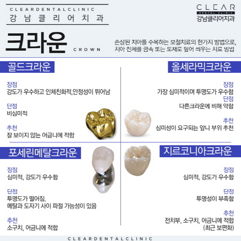 강남신경치료 늦어지면 안돼는 중요한 치료 관련 이미지 8