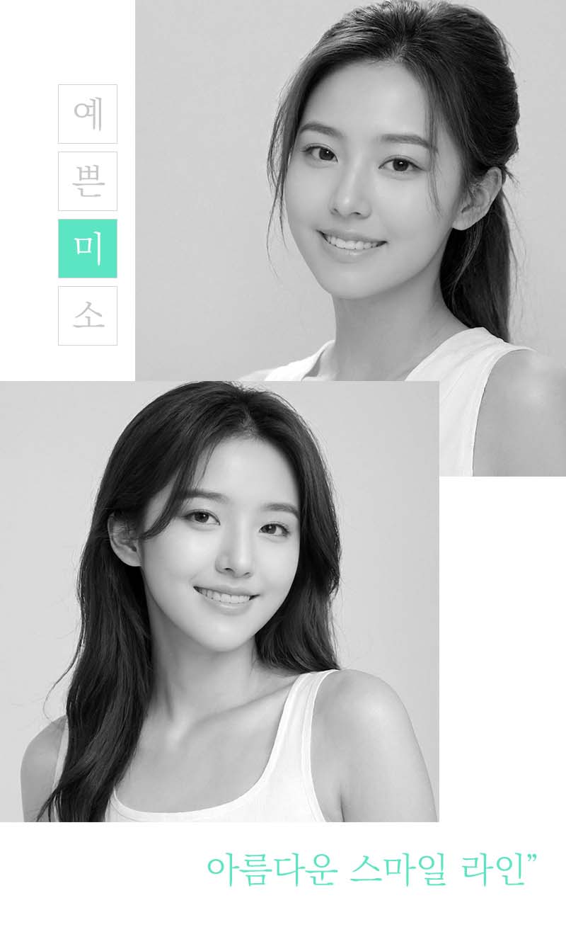 강남클리어치과 라미네이트 적절한 치아삭제가 관건 관련 이미지 3