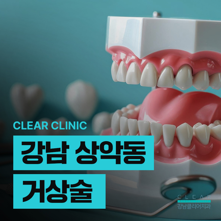 강남 상악동 거상술 난이도가 높으니까 관련 이미지 1