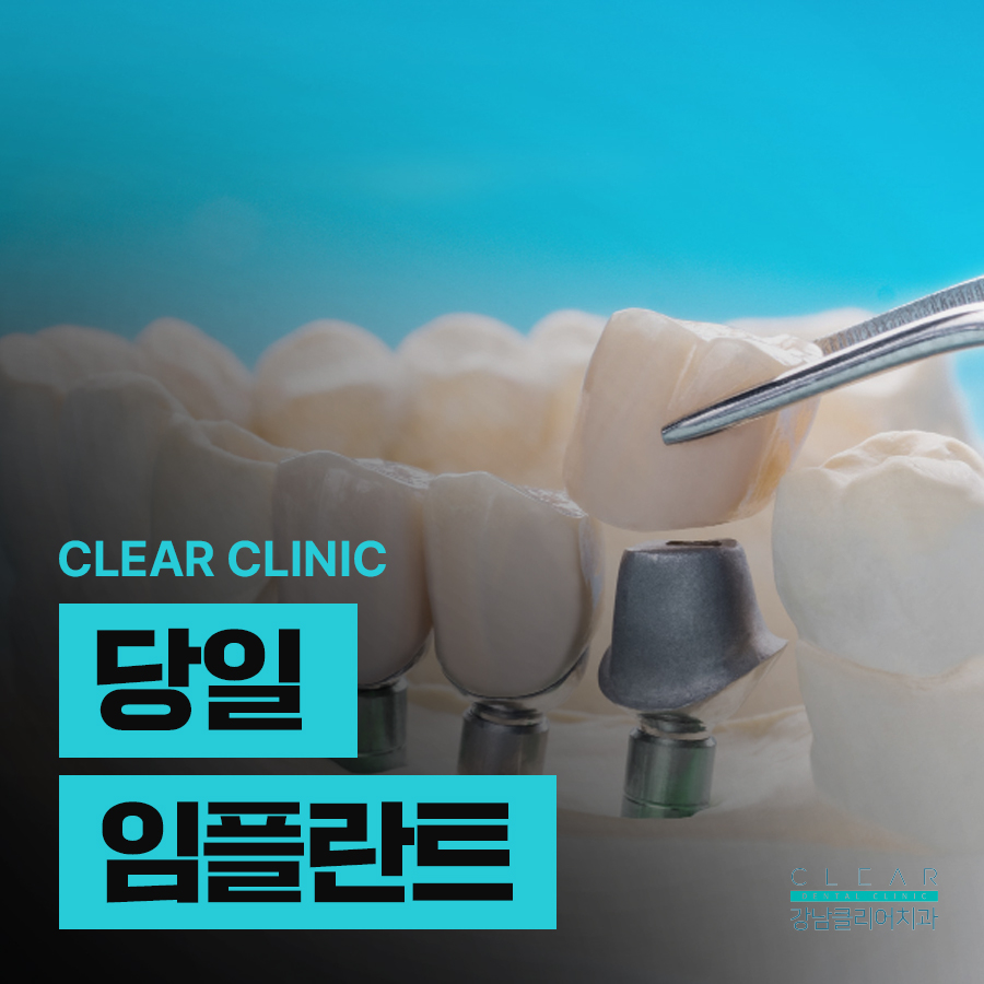 당일 임플란트 조건 무엇이 필요할까 관련 이미지 1