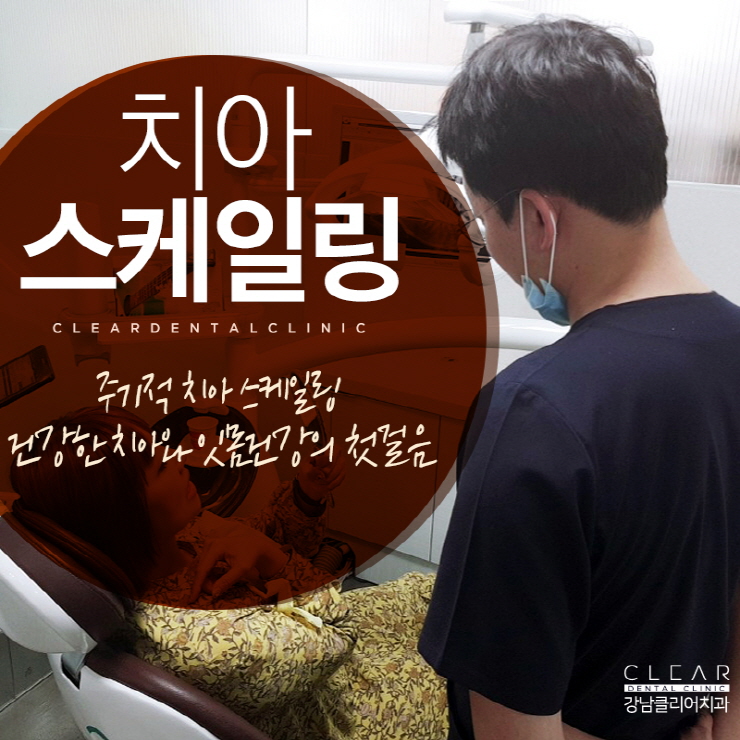 치아 스케일링 가격 건강보험 적용으로 부담없이 관련 이미지 1