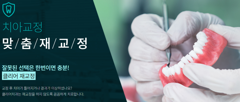 논현동치아교정 심미적인 부분을 놓치기 싫다면? 관련 이미지 9
