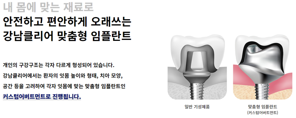 역삼동임플란트치과 찾는다면 강남클리어치과 정답! 관련 이미지 5