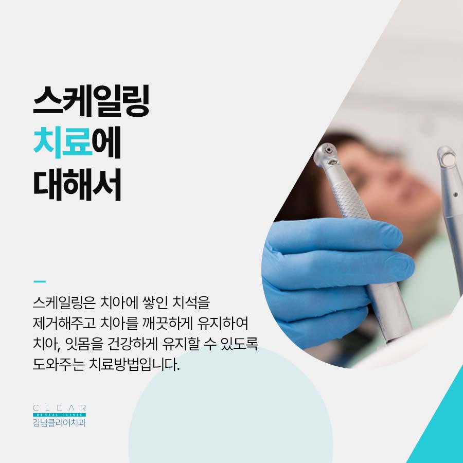 역삼역 치과 스케일링 치료 피가 나는 이유 관련 이미지 2
