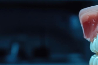 임플란트 빠졌을때 빠지는 이유 대처법 알려드려요 관련 이미지 18