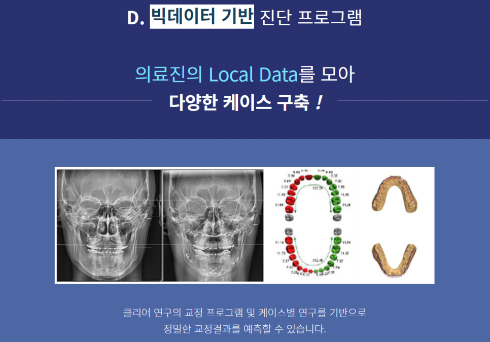 강남투명교정 보철에 대한 부담을 적게! 관련 이미지 8