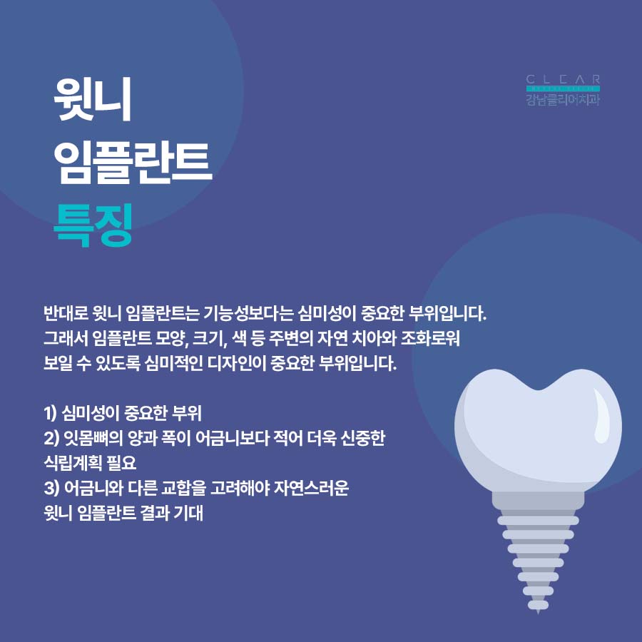 강남역 임플란트치과 앞니 어금니 부위에 따라 달라 관련 이미지 4