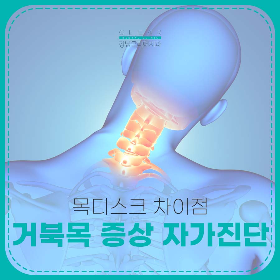거북목 증상 자가진단 목디스크 차이점 관련 이미지 1