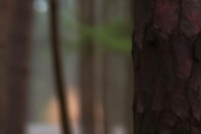 왼쪽 옆구리 콕콕 통증 원인 총정리 관련 이미지 8