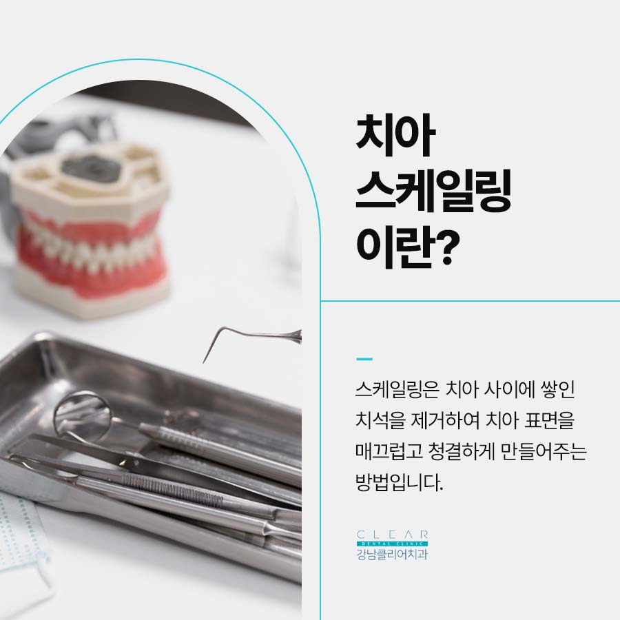 클리어치과 스케일링 주기 놓치지 말고 관련 이미지 2