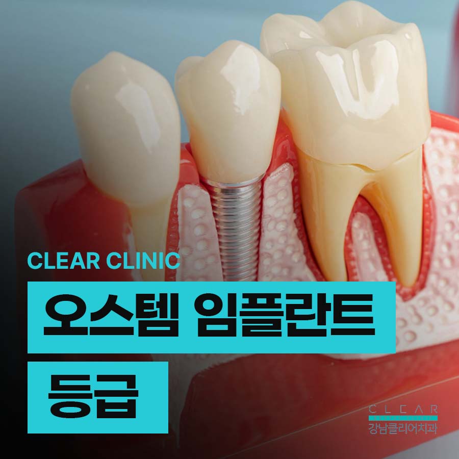 오스템 임플란트 등급 장단점 비교 정리 관련 이미지 1