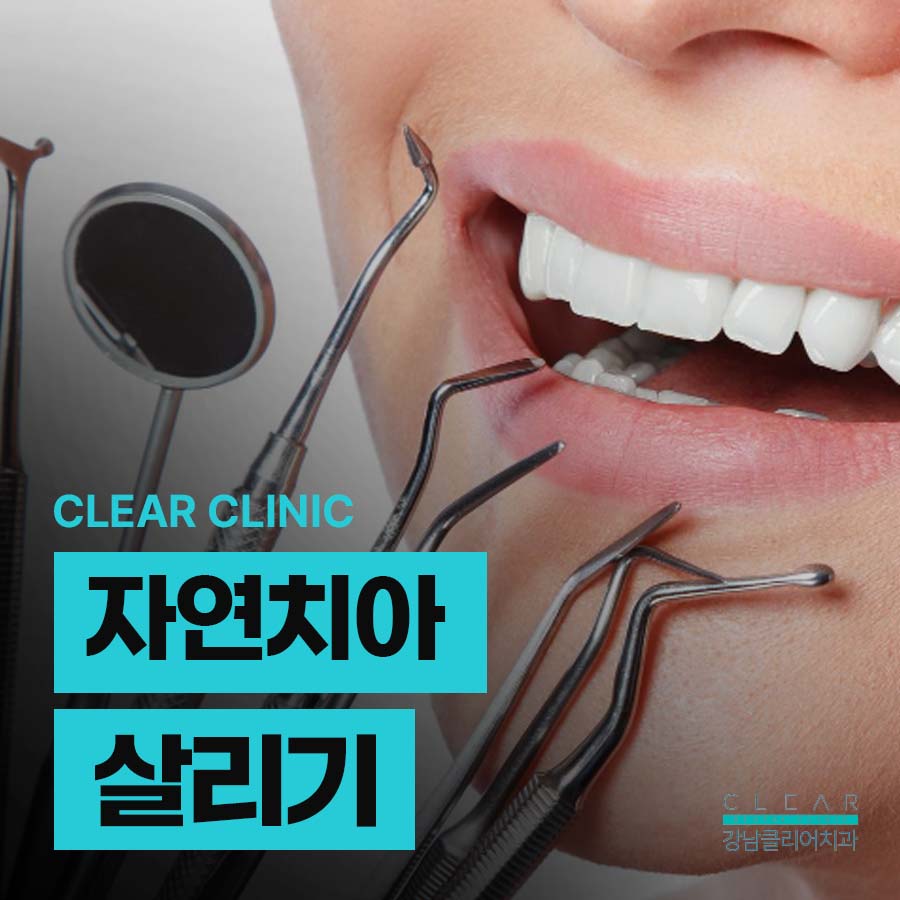 자연치아살리기 신경치료 시기 놓치면 안되는 이유 관련 이미지 1