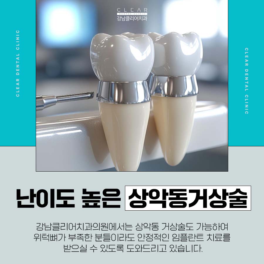 강남클리어치과 상악동 거상술도 가능하니까 관련 이미지 2