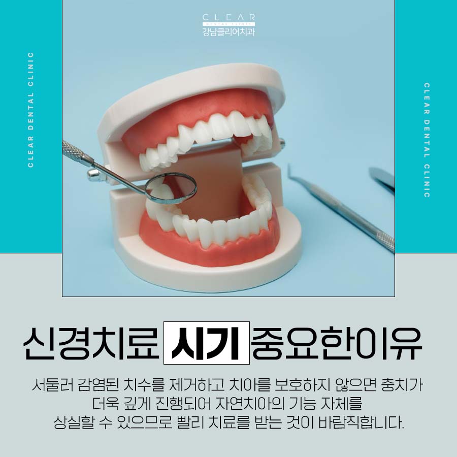 자연치아살리기 신경치료 시기 놓치면 안되는 이유 관련 이미지 2