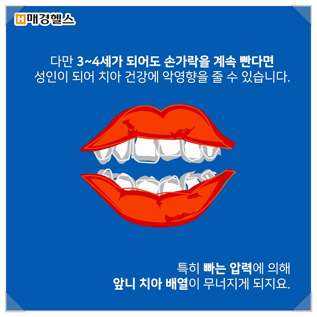 클리어 치과 상식 - 앞니 부분교정 전 꿀팁! 관련 이미지 6