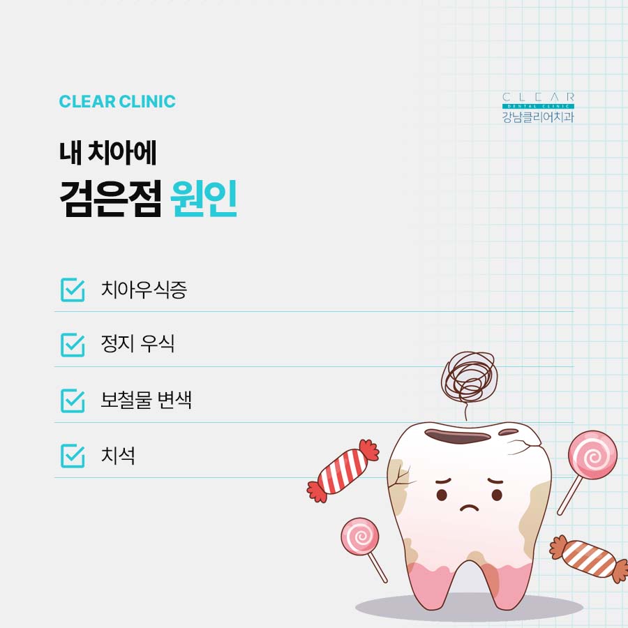 치아 검은점 원인 치료방법 정리 관련 이미지 2
