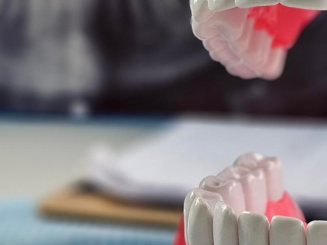 신경치료 후 통증이 생기는 이유 관련 이미지 19