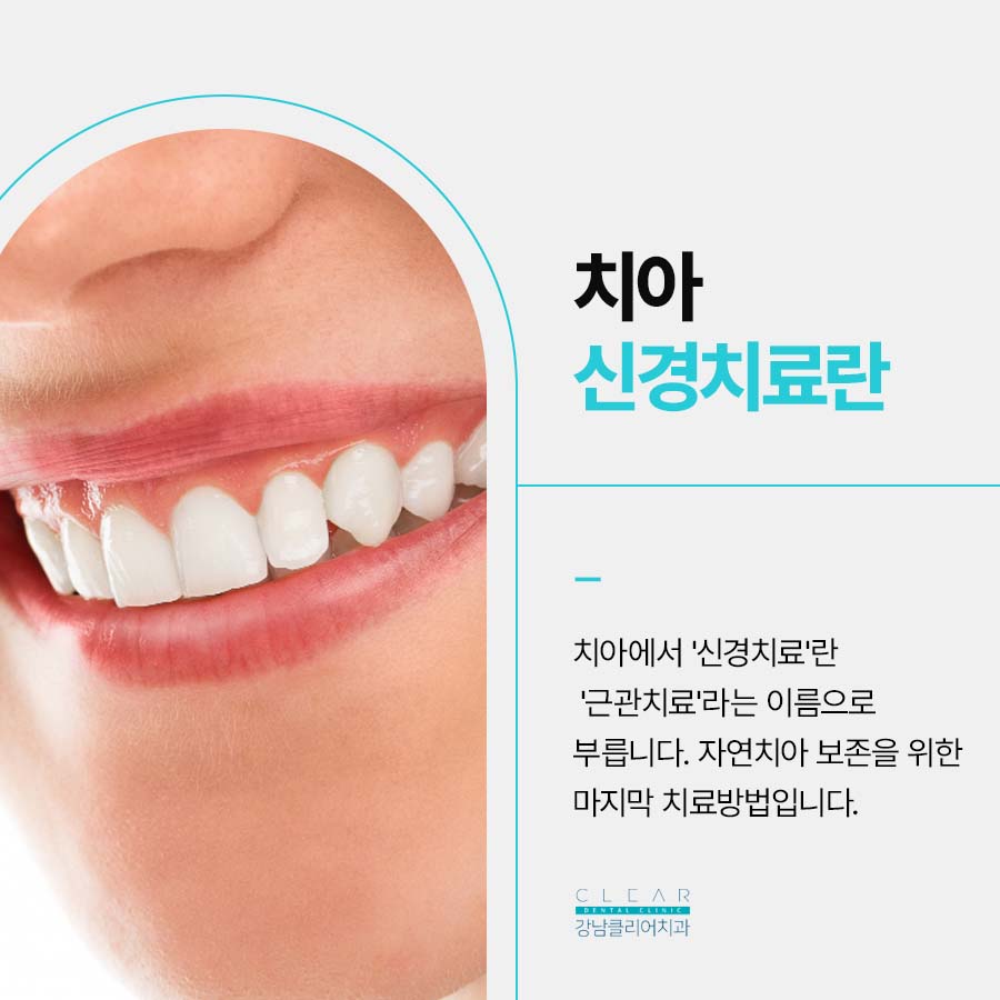 클리어치과 신경치료 과정 꼼꼼해야 하는 이유 관련 이미지 2