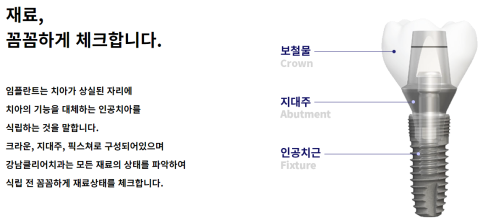 강남역치과임플란트 튼튼한 식립을 위한 선택 관련 이미지 4